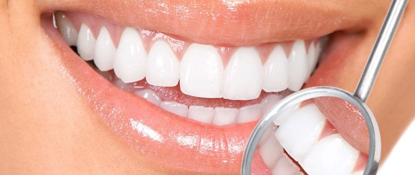 Зачем отбеливать зубы
