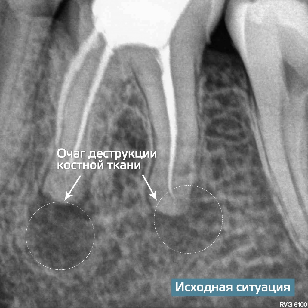 Новости стоматологической клиники Киостом